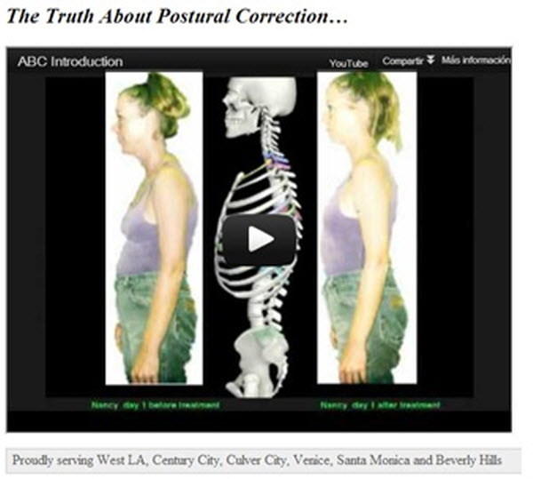 the truth about postural correction